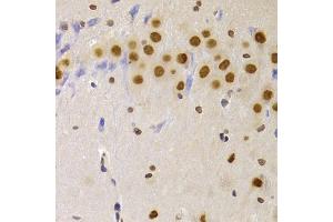 Immunohistochemistry of paraffin-embedded rat brain using HNRNPA1 Antibody (ABIN5975570) at dilution of 1/100 (40x lens). (HNRNPA1 antibody)