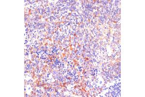 Immunohistochemistry of paraffin-embedded mouse spleen using ROCK1 antibody (ABIN6129454, ABIN6147066, ABIN6147067 and ABIN7101352) at dilution of 1:100 (40x lens). (ROCK1 antibody  (AA 400-660))