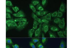 Immunofluorescence analysis of U-2 OS cells using EIF3D Polyclonal Antibody at dilution of 1:100. (EIF3D antibody)
