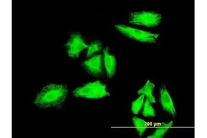 Immunofluorescence of monoclonal antibody to MKNK1 on HeLa cell. (MKNK1 antibody  (AA 1-465))