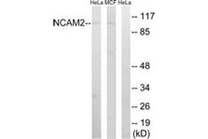 Western blot analysis of extracts from MCF-7/HeLa cells, using NCAM2 Antibody. (NCAM2 antibody  (AA 264-313))