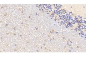 Detection of BMP2 in Mouse Cerebellum Tissue using Polyclonal Antibody to Bone Morphogenetic Protein 2 (BMP2) (BMP2 antibody  (AA 281-394))