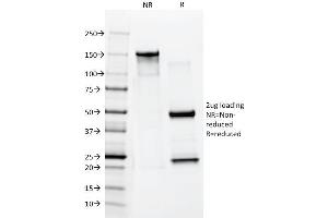SDS-PAGE Analysis Purified Cytokeratin 10 Mouse Monoclonal Antibody (AE20). (Keratin 10 antibody)