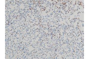 ABIN6255180 and ABIN6267443 at 1/100 staining mouse lung tissue sections by IHC-P.