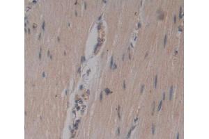 IHC-P analysis of Kidney tissue, with DAB staining. (Junctophilin 1 antibody  (AA 1-201))