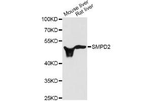 Western blot analysis of extracts of various cell lines, using SMPD2 antibody (ABIN1874877) at 1:3000 dilution. (SMPD2 antibody)