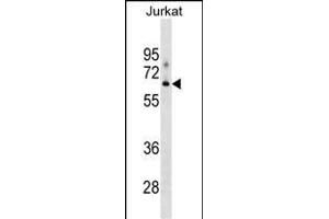 XYLB Antibody (N-term) (ABIN1539119 and ABIN2849290) western blot analysis in Jurkat cell line lysates (35 μg/lane). (XYLB antibody  (N-Term))
