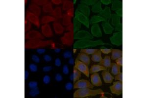 ABIN6263693 and ABIN6278598 staining Hela cells(30 min of UV treatment) by IF/ICC.