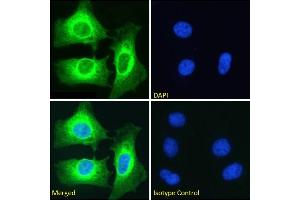 Immunofluorescence staining of fixed HeLa cells with anti-NFKB2 antibody SAIC-26C-15. (Recombinant NFKB2 antibody)