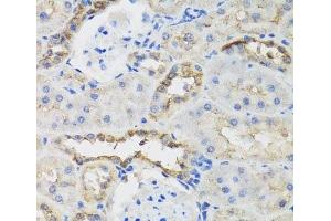 Immunohistochemistry of paraffin-embedded Rat kidney using B9D1 Polyclonal Antibody at dilution of 1:100 (40x lens). (B9D1 antibody)