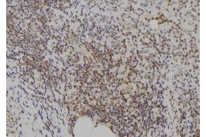 ABIN6273574 at 1/100 staining Human spleen tissue by IHC-P. (E2F7 antibody)
