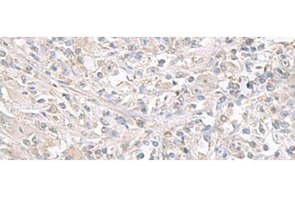 FXYD6 antibody