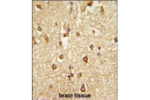 Formalin-fixed and paraffin-embedded human brain tissue reacted with DLX2 Antibody , which was peroxidase-conjugated to the secondary antibody, followed by DAB staining. (DLX2 antibody  (AA 194-222))