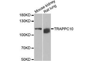 Western blot analysis of extracts of various cell lines, using TRAPPC10 antibody. (TRAPPC10 antibody)