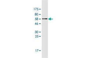 Western Blot detection against Immunogen (57. (XPA antibody  (AA 1-273))