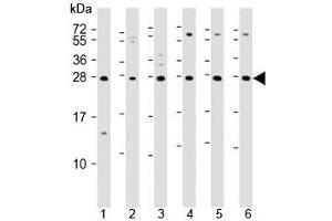 Western blot testing of 1) mouse EL4, human 2) fetal thymus, 3) spleen, 4) HUT78, 5) Jurkat and 6) Molt-4 lysate with TIGIT antibody.