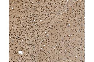 IHC analysis of Proteasome 20S Beta 7/PSMB7 using anti-Proteasome 20S Beta 7/PSMB7 antibody (ABIN7600256).