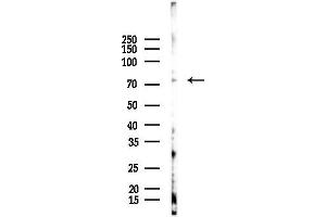 Western blot analysis of lysates from EC304 cells(heat-shock 45 min treatment), using MeCP2 Antibody at 1/1000 dilution.