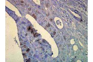 Immunohistochemistry analysis using Mouse Anti-Hsp70 Monoclonal Antibody, Clone C92 . (HSP70 antibody  (Biotin))