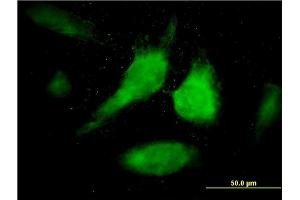 Immunofluorescence (IF) image for anti-Signal Transducer and Activator of Transcription 1, 91kDa (STAT1) (AA 613-712) antibody (ABIN563024)