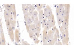 Detection of PDGFB in Porcine Cardiac Muscle Tissue using Polyclonal Antibody to Platelet Derived Growth Factor Subunit B (PDGFB) (PDGFB antibody  (AA 84-199))