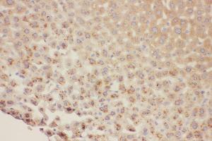 Anti-HNF1 beta antibody, IHC(P) IHC(P): Mouse Liver Tissue (HNF1B antibody  (C-Term))