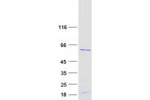 Western Blotting (WB) image for Ribosomal RNA Processing 9, Small Subunit (SSU) Processome Component, Homolog (RRP9) protein (Myc-DYKDDDDK Tag) (ABIN2731059)