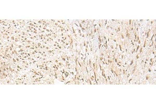 PSPC1 antibody
