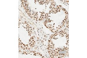C staining HS in human testis tissue sections by Immunohistochemistry (IHC-P - paraformaldehyde-fixed, paraffin-embedded sections). (HSPA7 antibody  (AA 169-196))