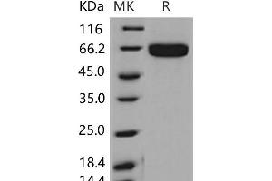 Western Blotting (WB) image for EPH Receptor A2 (EPHA2) (Active) protein (His tag) (ABIN7195518)
