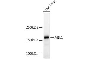 Western blot analysis of extracts of Rat liver, using c-Abl Rabbit pAb (ABIN3020871, ABIN3020872, ABIN3020873 and ABIN6213767) at 1:500 dilution.