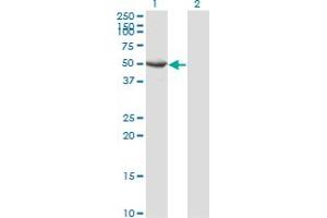 Western Blot analysis of SEPT10 expression in transfected 293T cell line by SEPT10 monoclonal antibody (M02), clone 3A9. (Septin 10 antibody  (AA 1-454))