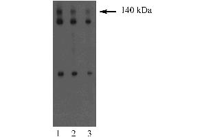 Western blot analysis of Dlg on an A431 cell lysate (Human epithelial carcinoma, ATCC CRL-1555). (DLG1 antibody  (AA 5-213))