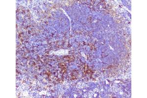 IHC analysis of RP2 using anti-RP2 antibody (ABIN6719513). (RP2 antibody  (AA 244-348))
