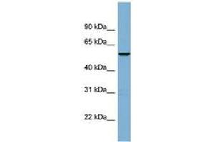 Image no. 1 for anti-CCR4-NOT Transcription Complex, Subunit 11 (CNOT11) (AA 215-264) antibody (ABIN6742003) (CNOT11 antibody  (AA 215-264))