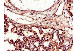 Immunohistochemistry of paraffin-embedded human lung tissue using ABIN7156533 at dilution of 1:100