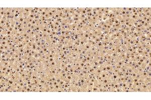 Immunohistochemistry (IHC) image for anti-Transketolase (TKT) (AA 1-294) antibody (ABIN7436402)