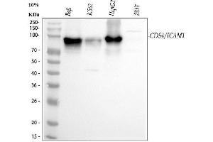 Western blot analysis of ICAM1 using anti-ICAM1 antibody (ABIN5692991).