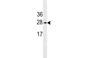 Western Blotting (WB) image for anti-Erythropoietin (EPO) (AA 20-48) antibody (ABIN3030867)