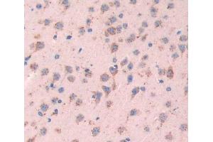 Used in DAB staining on fromalin fixed paraffin- embedded brain tissue (SYN2 antibody  (AA 88-422))
