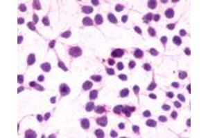 Anti-CNR1 / CB1 antibody immunocytochemistry (ICC) staining of untransfected HEK293 human embryonic kidney cells. (CNR1 antibody  (C-Term))