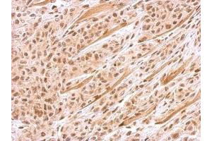 IHC-P Image FANCJ antibody [N1N2], N-term detects BRIP1 protein at nucleus on SAS xenograft by immunohistochemical analysis. (BRIP1 antibody  (N-Term))