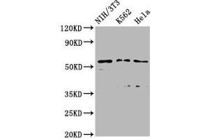 Western Blot Positive WB detected in: NIH/3T3 whole cell lysate, K562 whole cell lysate, Hela whole cell lysate All lanes: TTC26 antibody at 2. (TTC26 antibody  (AA 5-122))