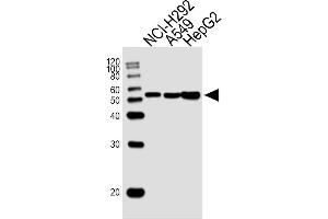 Lane 1: NCI-H292 Cell lysates, Lane 2: A549 Cell lysates, Lane 3: HepG2 Cell lysates, probed with ALDH2 (138CT22. (ALDH2 antibody)