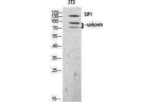 Western Blotting (WB) image for anti-Gem (Nuclear Organelle) Associated Protein 2 (GEMIN2) (N-Term) antibody (ABIN3177416) (SIP1 antibody  (N-Term))