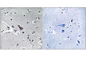 Immunohistochemistry analysis of paraffin-embedded human brain, using SLC6A16 Antibody. (SLC6A16 antibody  (AA 233-282))