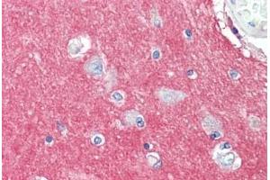 Human Brain, Cortex: Formalin-Fixed, Paraffin-Embedded (FFPE) (GNAI3 antibody  (AA 181-230))