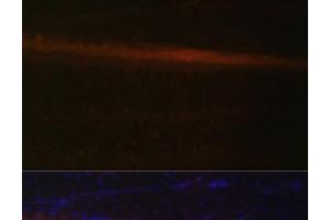 Immunofluorescence analysis of Rat retina using RDH5 Polyclonal Antibody at dilution of 1:100 (40x lens). (RDH5 antibody)