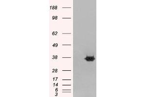 Western Blotting (WB) image for anti-Mortality Factor 4 Like 2 (MORF4L2) antibody (ABIN5871243) (MORF4L2 antibody)