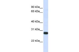 WB Suggested Anti-SPINT2 Antibody Titration:  0. (SPINT2 antibody  (Middle Region))